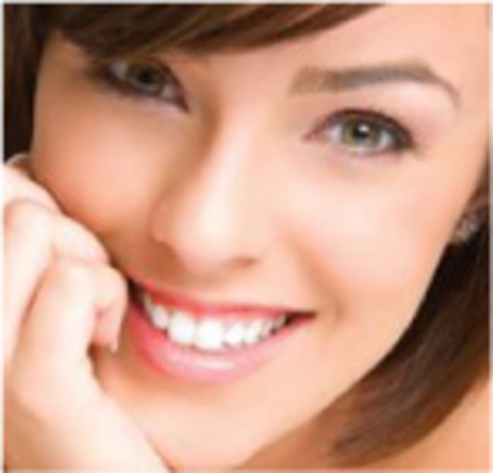 faccette dentali