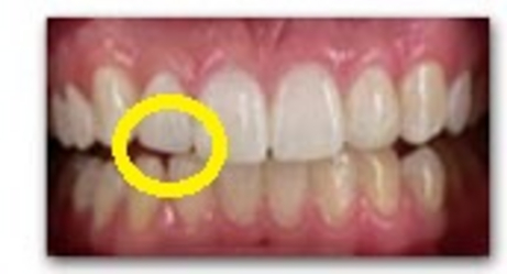 cura dentale