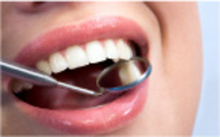 corone dentali
